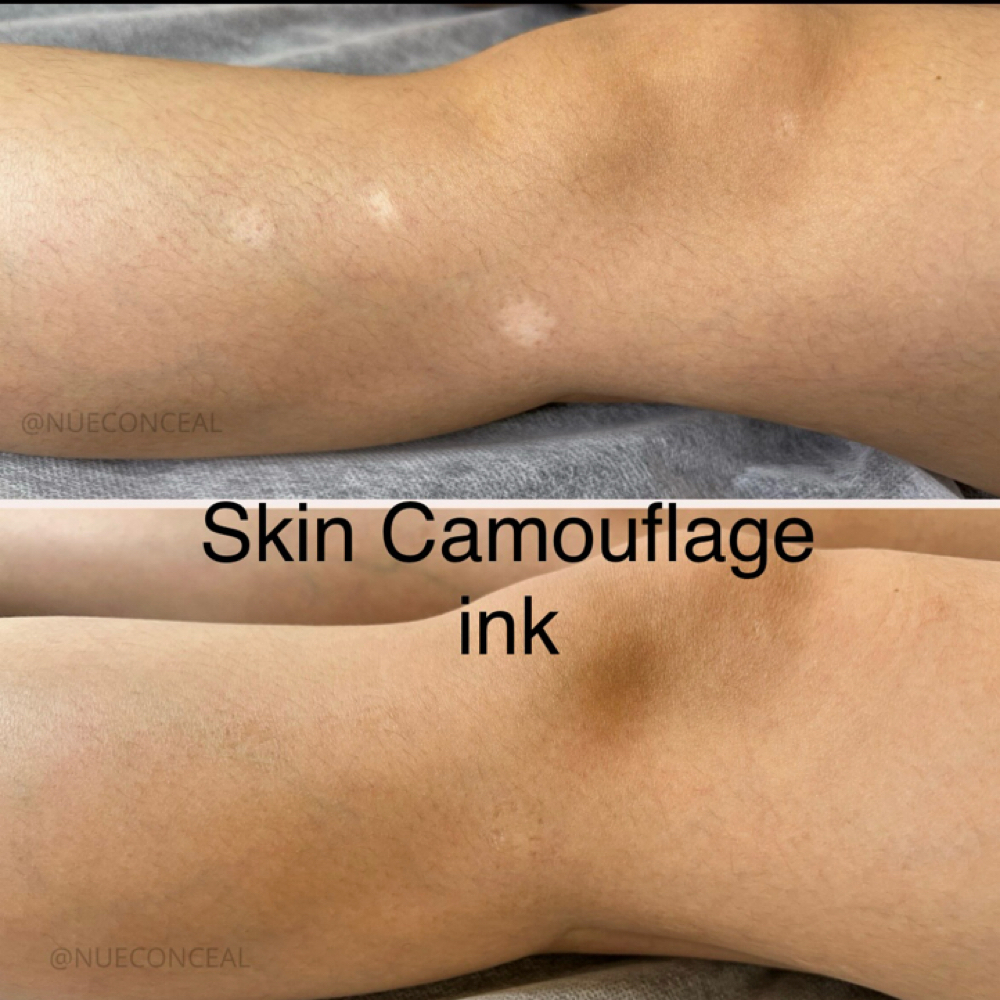 Camouflage Tattooing at Flawless Skin By Sarah in Roseville, CA