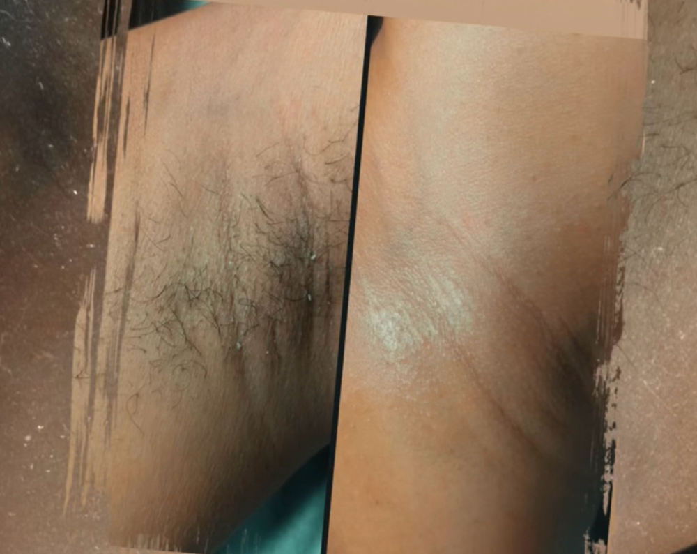 Underarm Wax