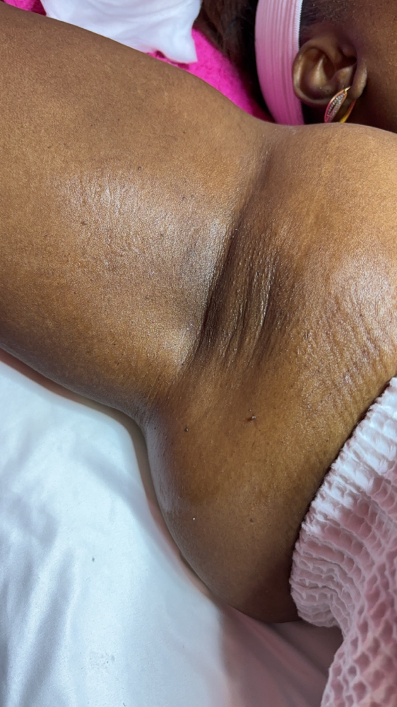 Underarm Wax