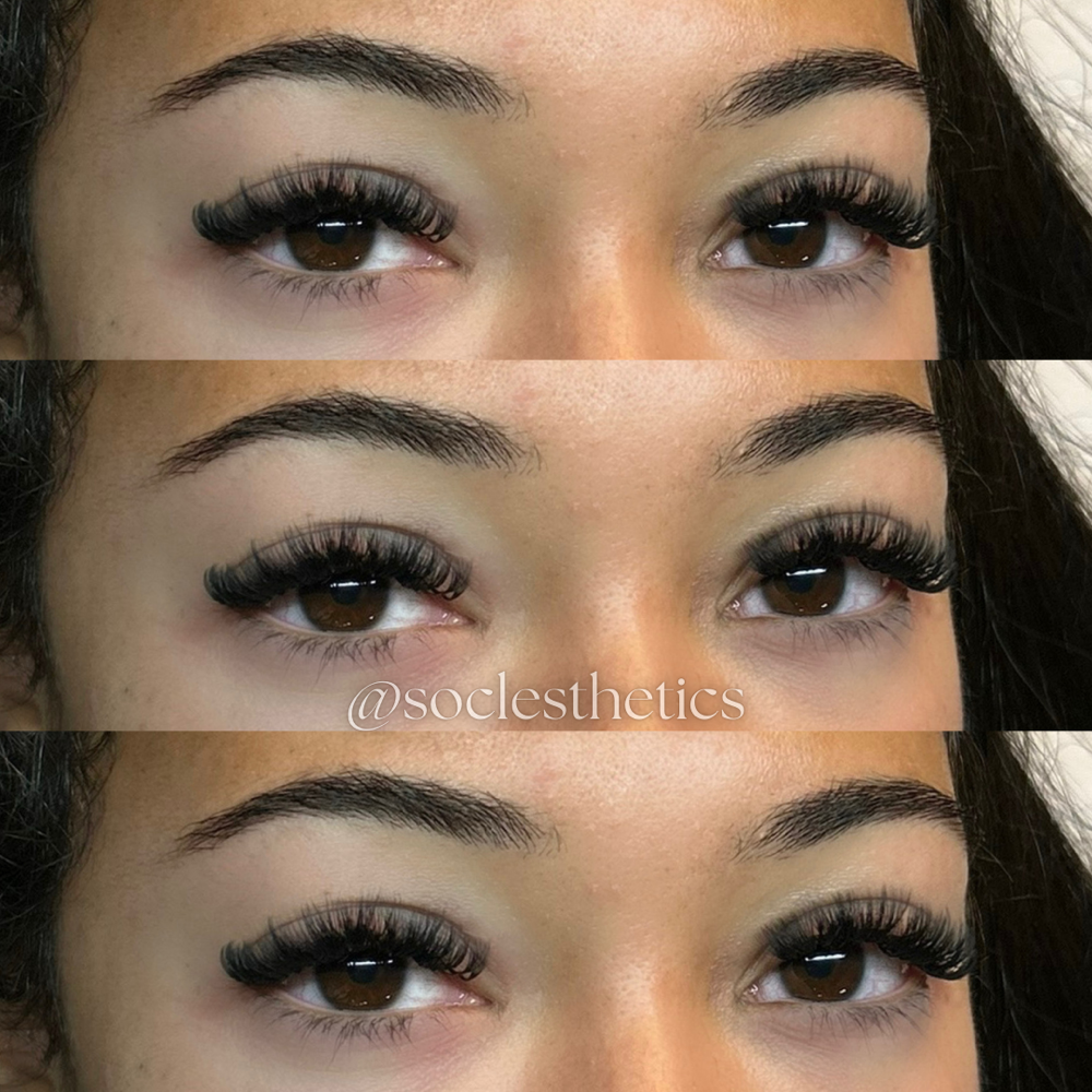 Soft Volume Full Set at SOCL Esthetics in Indianapolis, IN