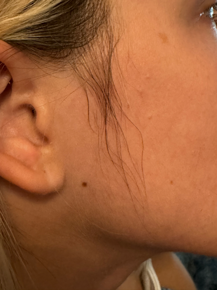 Sideburns