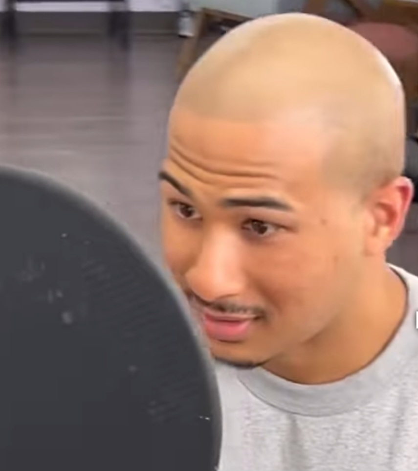 Scalp Micropigmentation