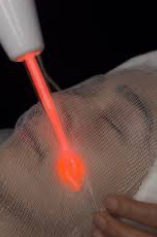 HIGH FREQUENCY THERAPY