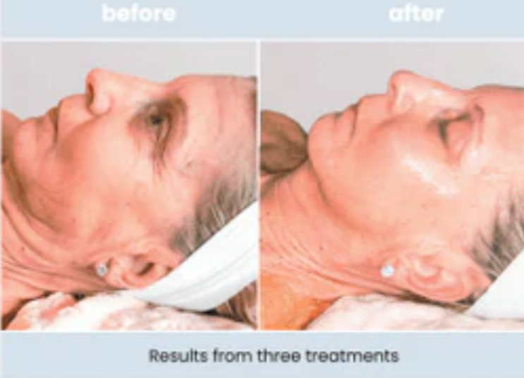 Swich Dermal Treatment Series