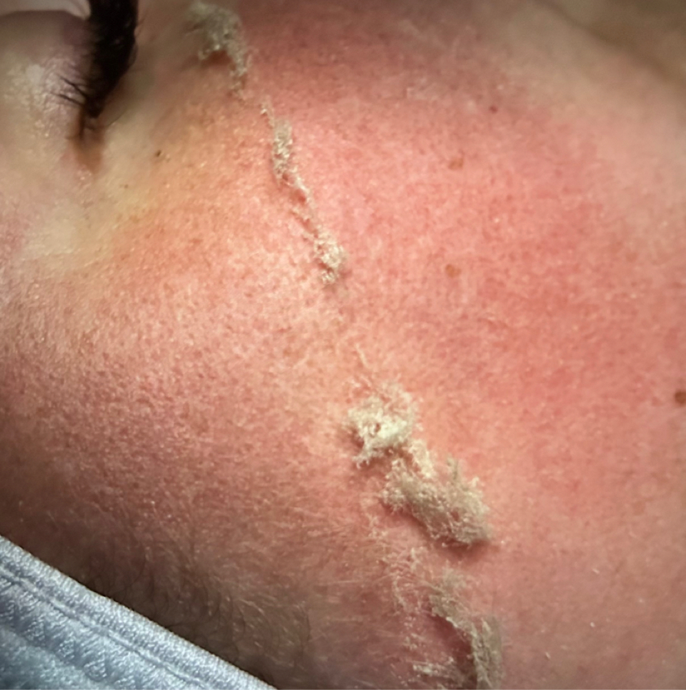Dermaplaning Add On To Any Facial at LaRue & Co in Maryville, TN