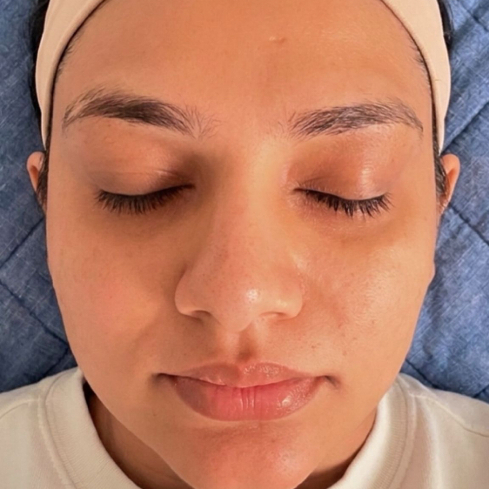 Skin Brightening Facial at Beautiess Esthetic in Concord, NC
