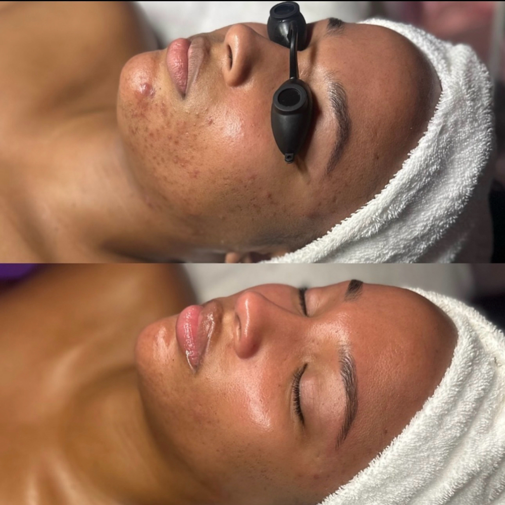 Youth Renewal Facial at Amethyst Spa in Omaha, NE