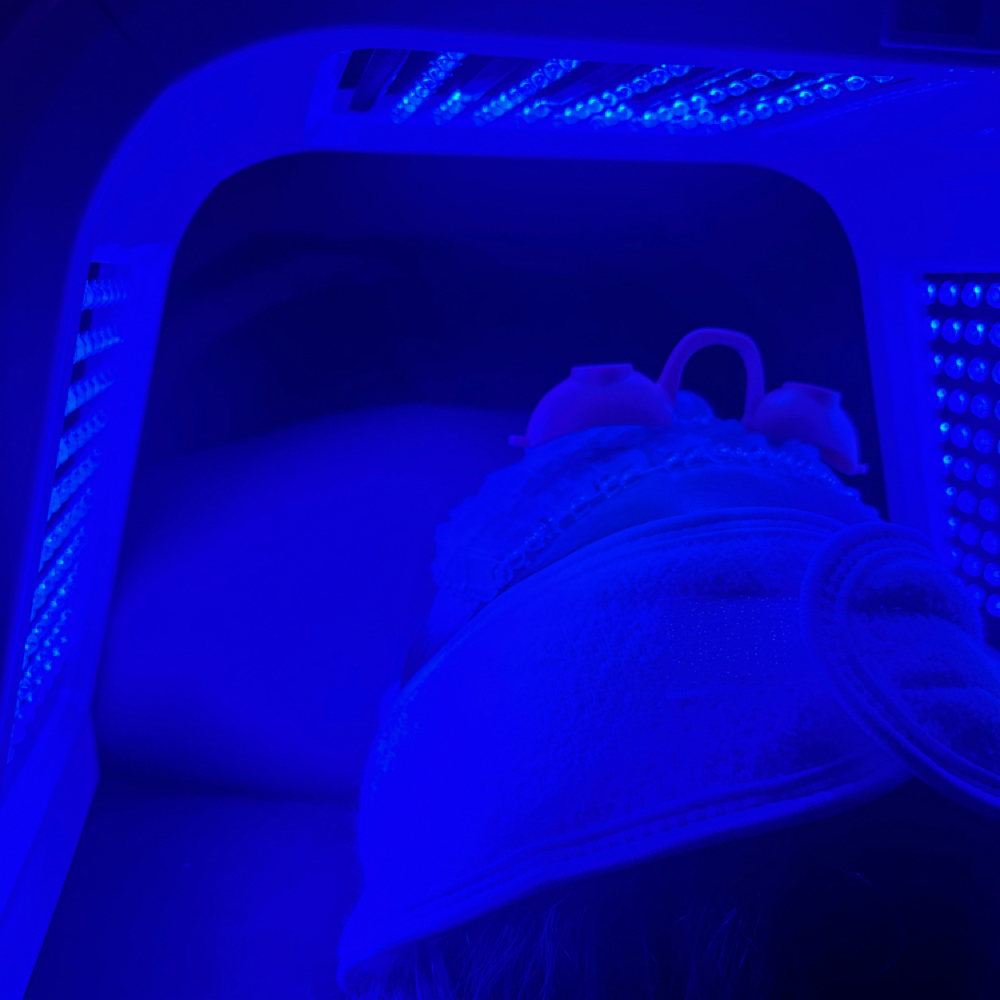 Acne Facial at skinbyanelisa in Tampa, FL