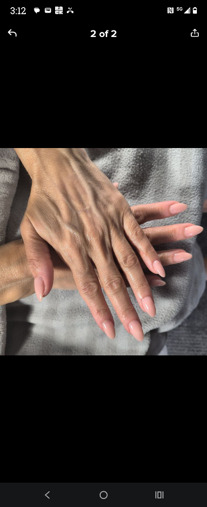 Gel Overlay With Removal