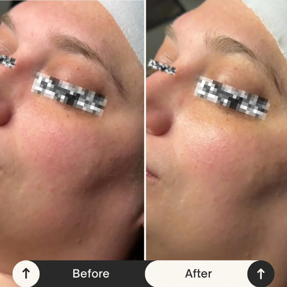 Calm + Repair facial at Gemini Esthetics in Naperville, IL