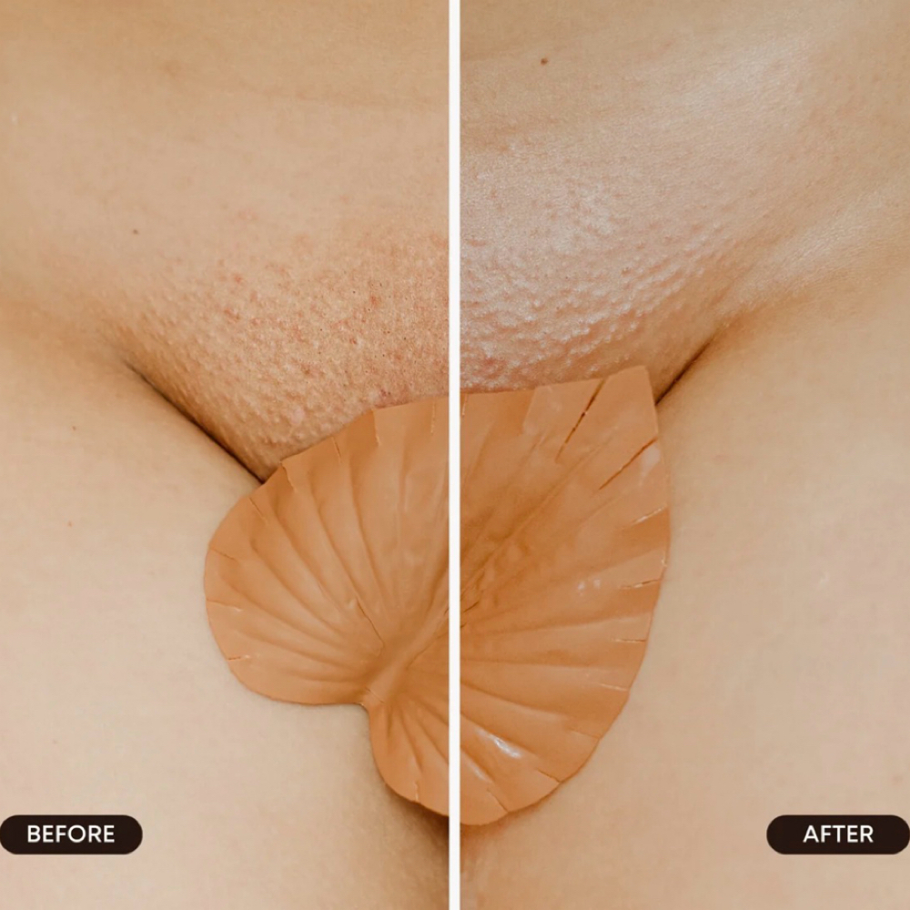 Hydrogel Vajacial Mask at Intimate Wax Studio in Cincinnati, OH