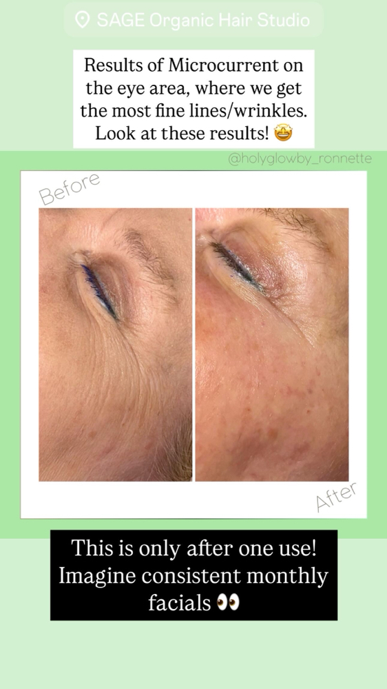 Rejuvenation Facial