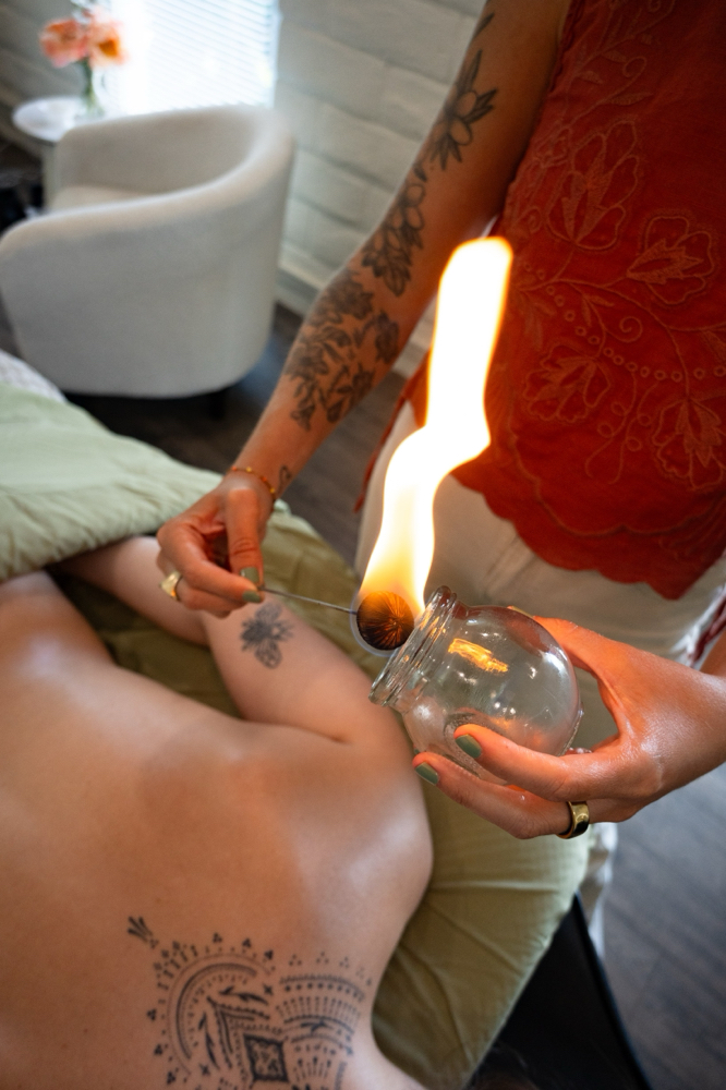 Cupping