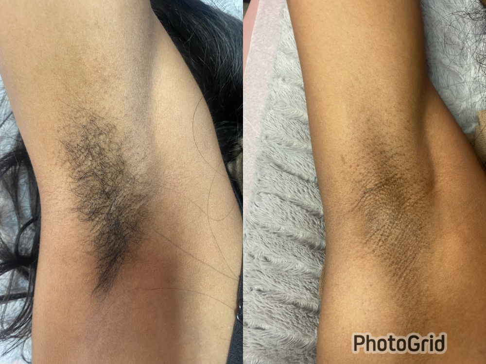 Underarm Wax