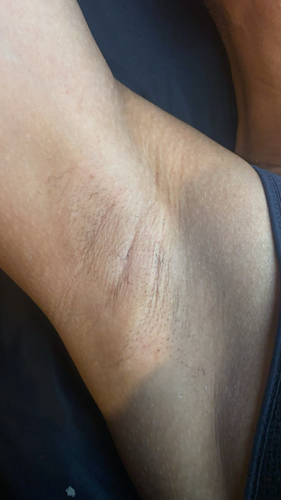 Underarm Wax