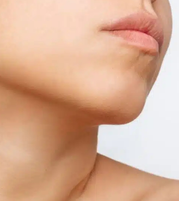 Chin