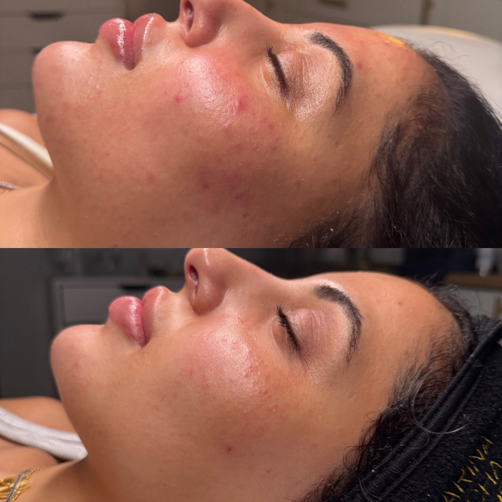 Oxygen RX Facial at Marina Rocha Esthetics in Greensboro, NC