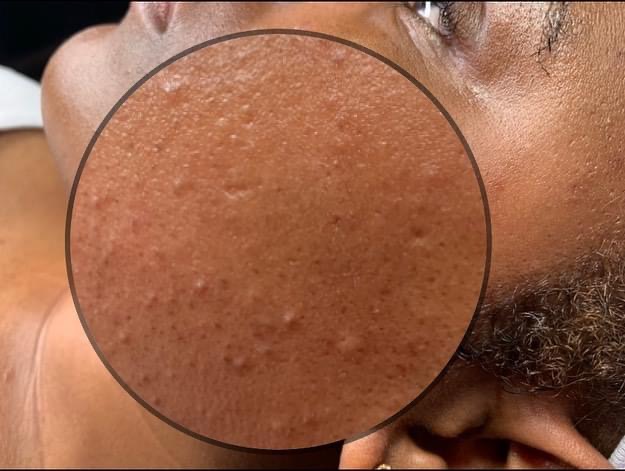 The LA Rx Signature New Client Faci