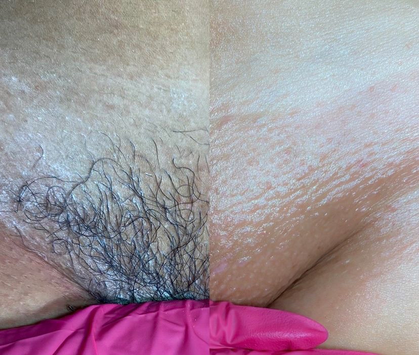 Brazilian Wax 1st Time
