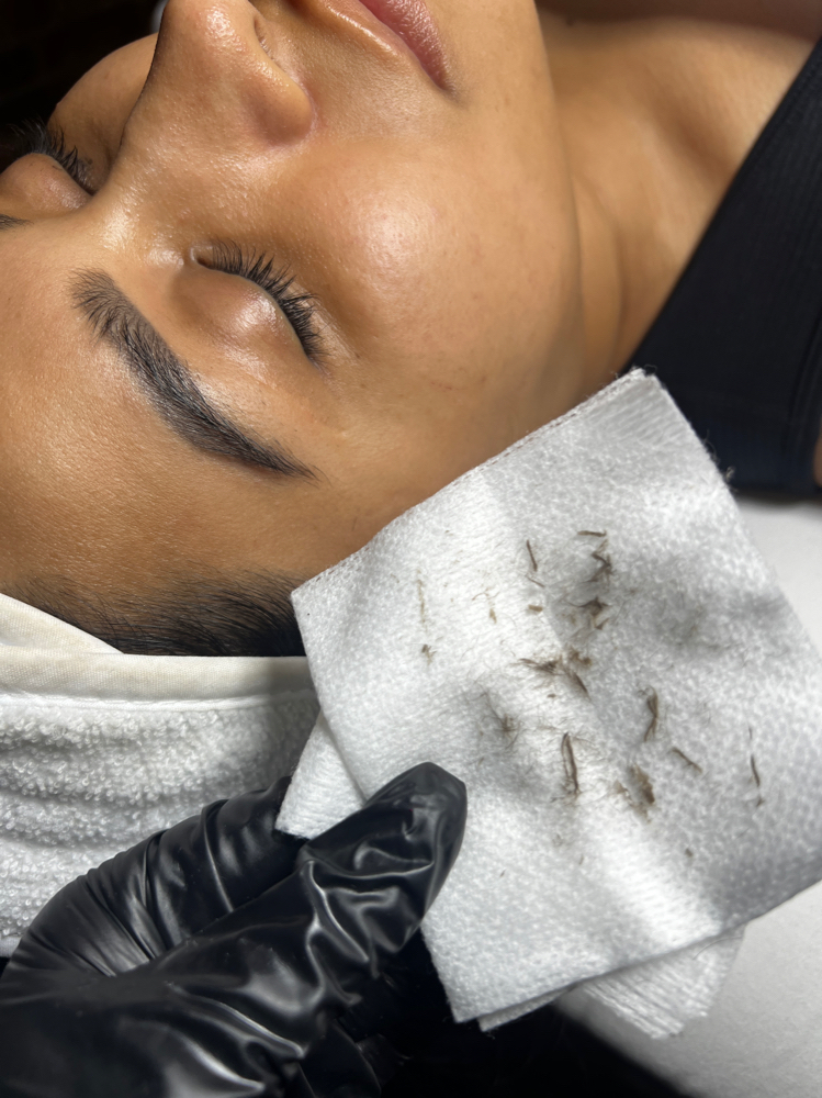 Dermaplaning Facial