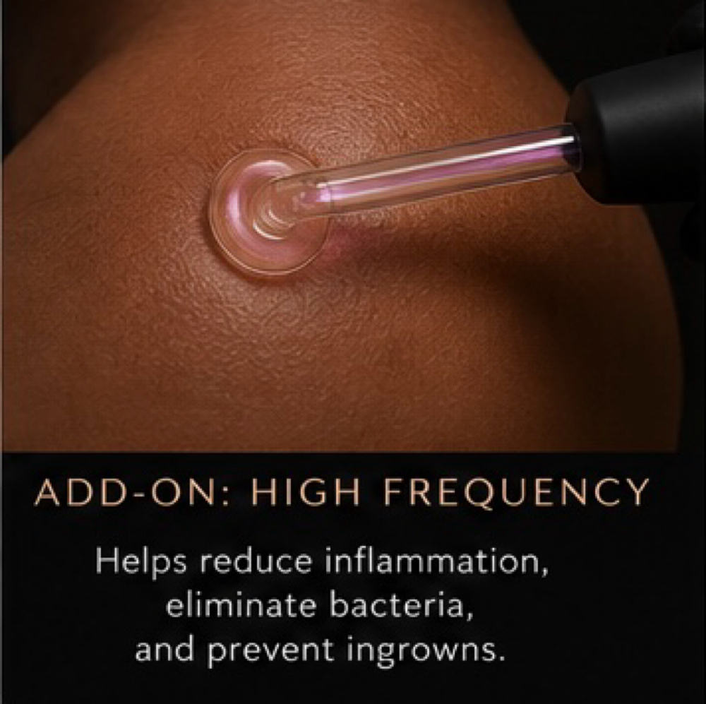High Frequency Treatment at NYYNE Aesthetics in Pearland, TX