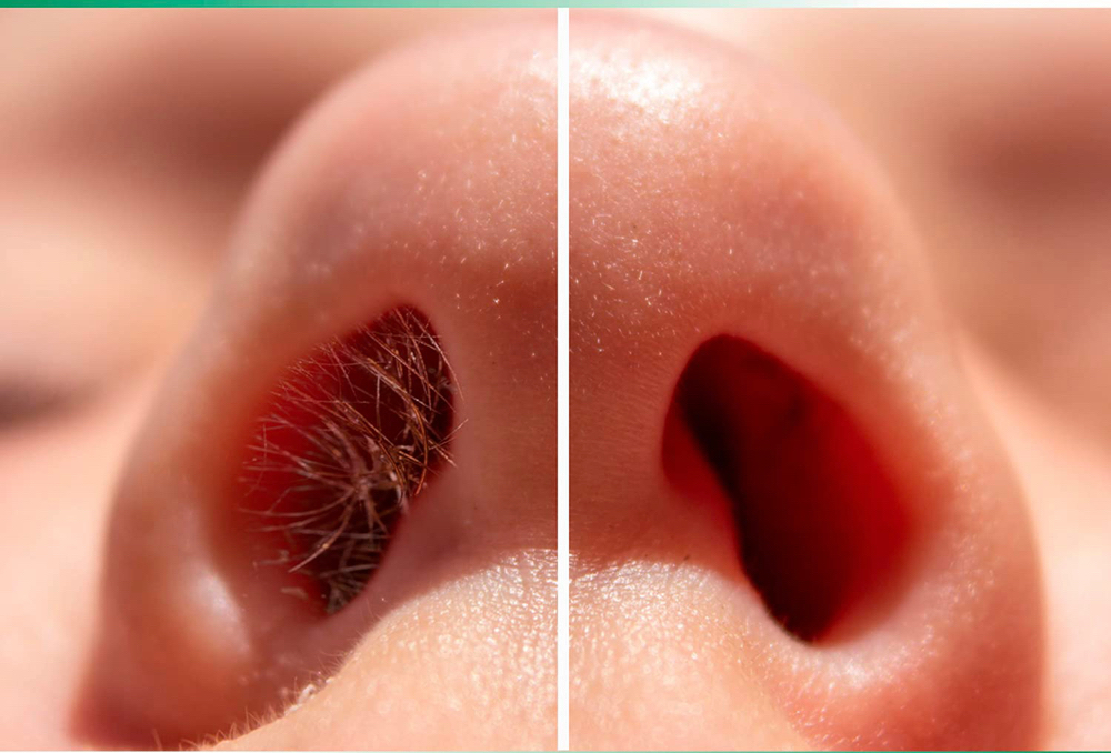 Nose