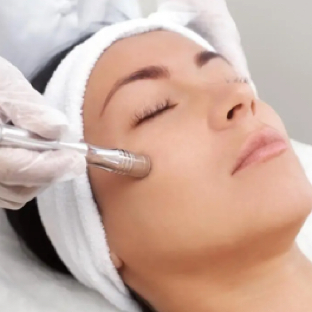 Microdermabrasion Facial at Hair Horizons in Schaumburg, IL