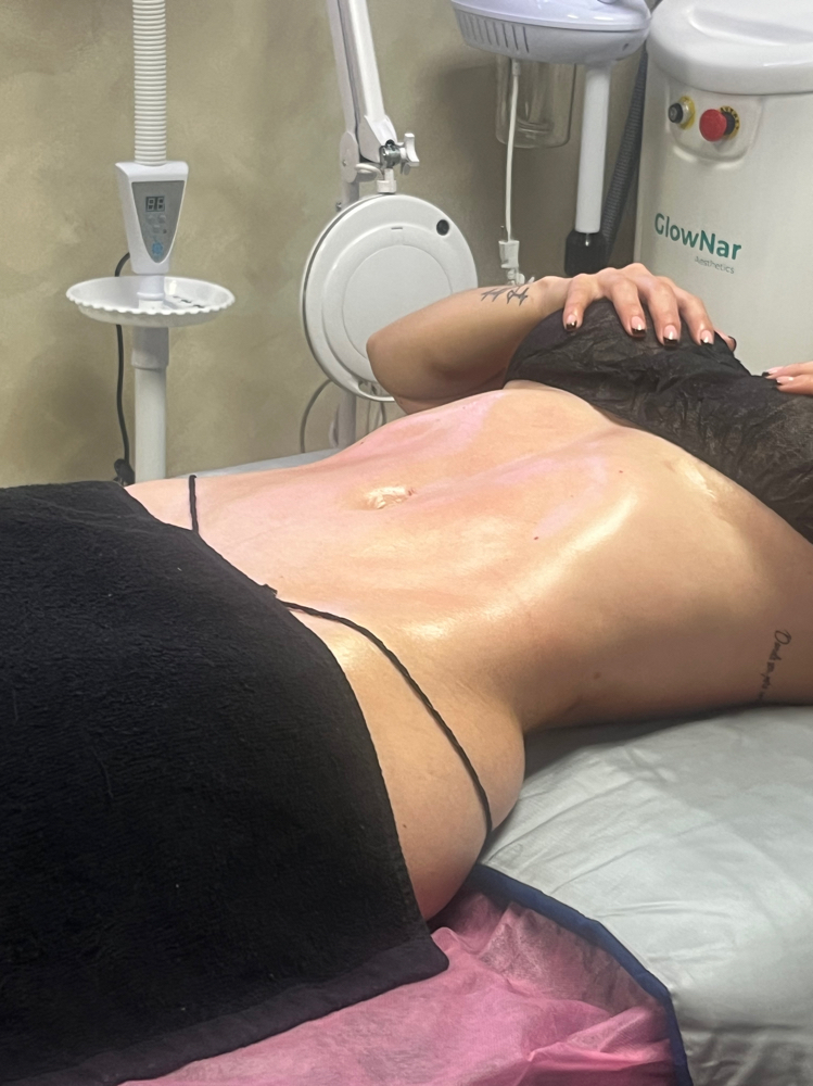 Masaje Post Op at Dream Body Esthetic in Orlando, FL