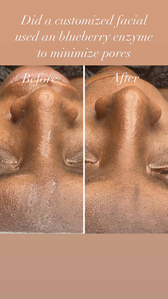 Anti-Aging Facial