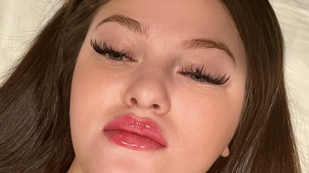 1 Lip Filler Syringe