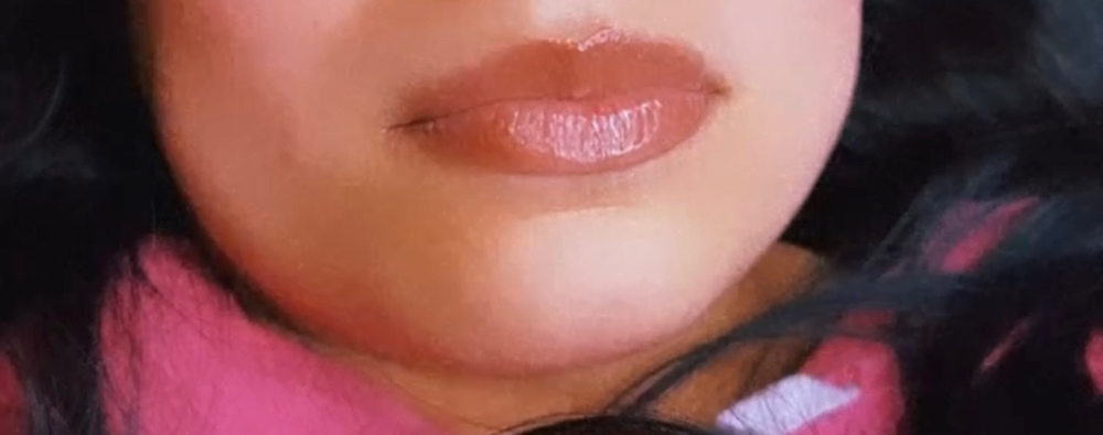 Hyaluronic Pen Lip Filler 1mL