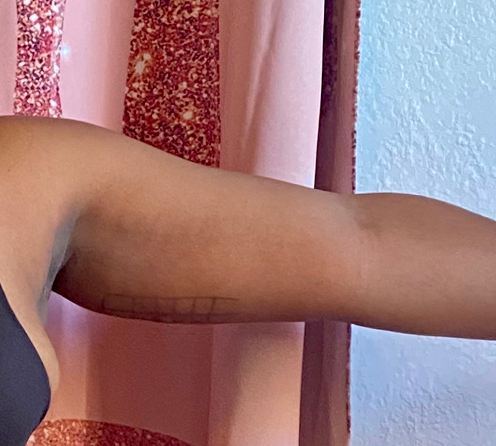 Liposhots Arms