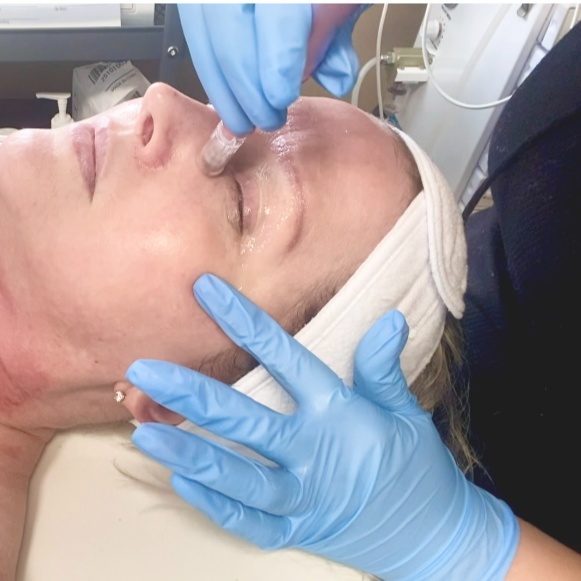 July - Nano Infusion Facial at Esthetique, Darling LLC in Indianapolis, IN