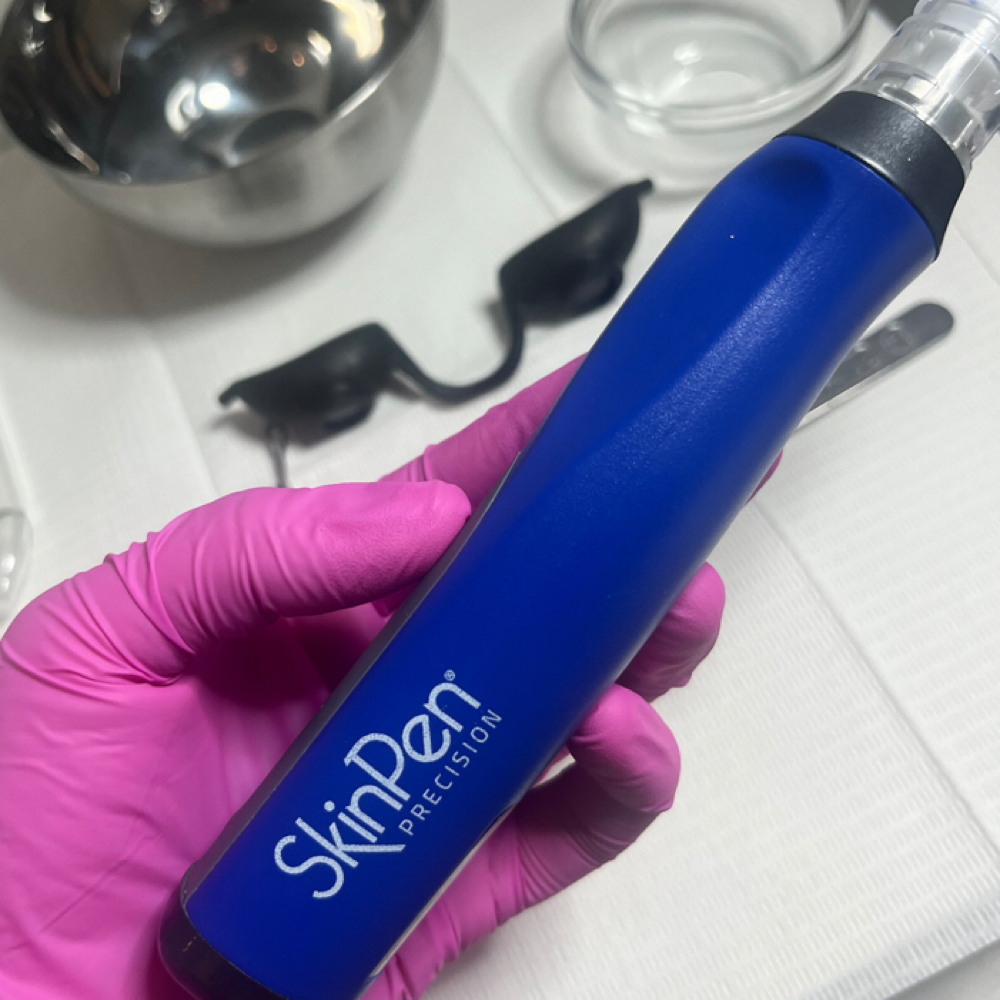 Microneedling at Cara Bella Esthetics in Tempe, AZ