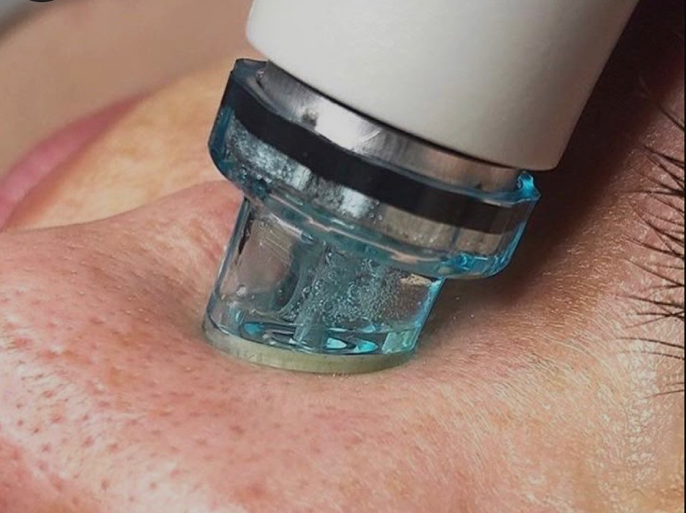 HydroLuxe Facial