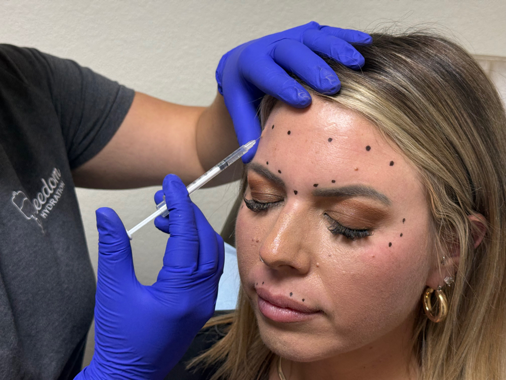 Masseter Treatment
