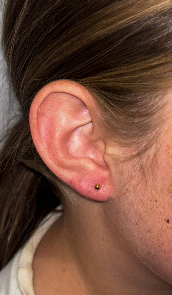Lobe (Single)