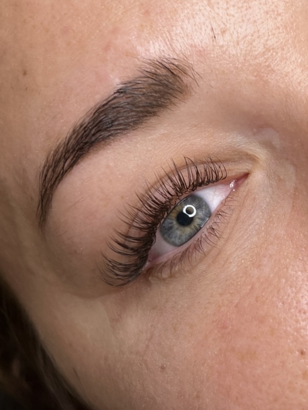 Classic 2 WK Fill (1-14 Days)