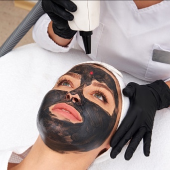 CARBON LASER FACIAL -SINGLE at VERSPA LASER AESTHETICS in Baldwin, NY