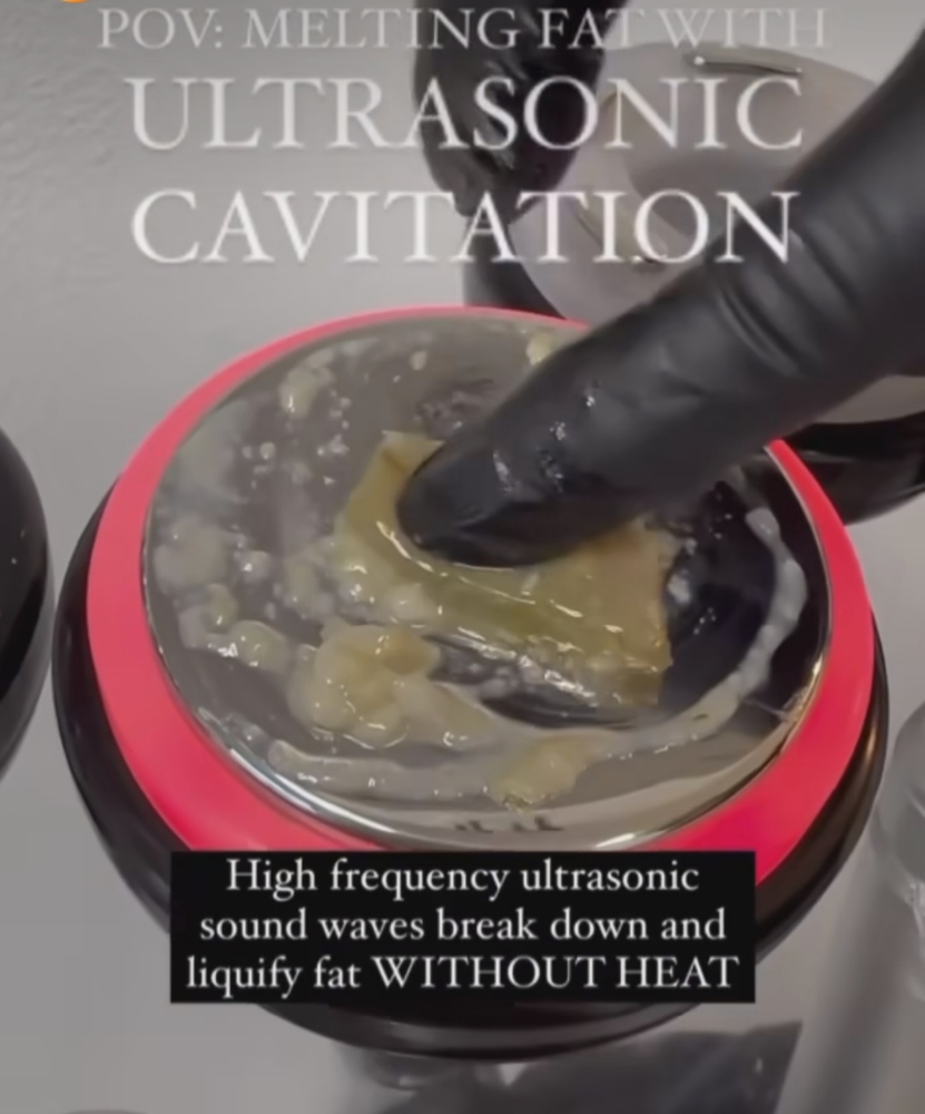 Fat Detox (Ultrasonic Cavitation)