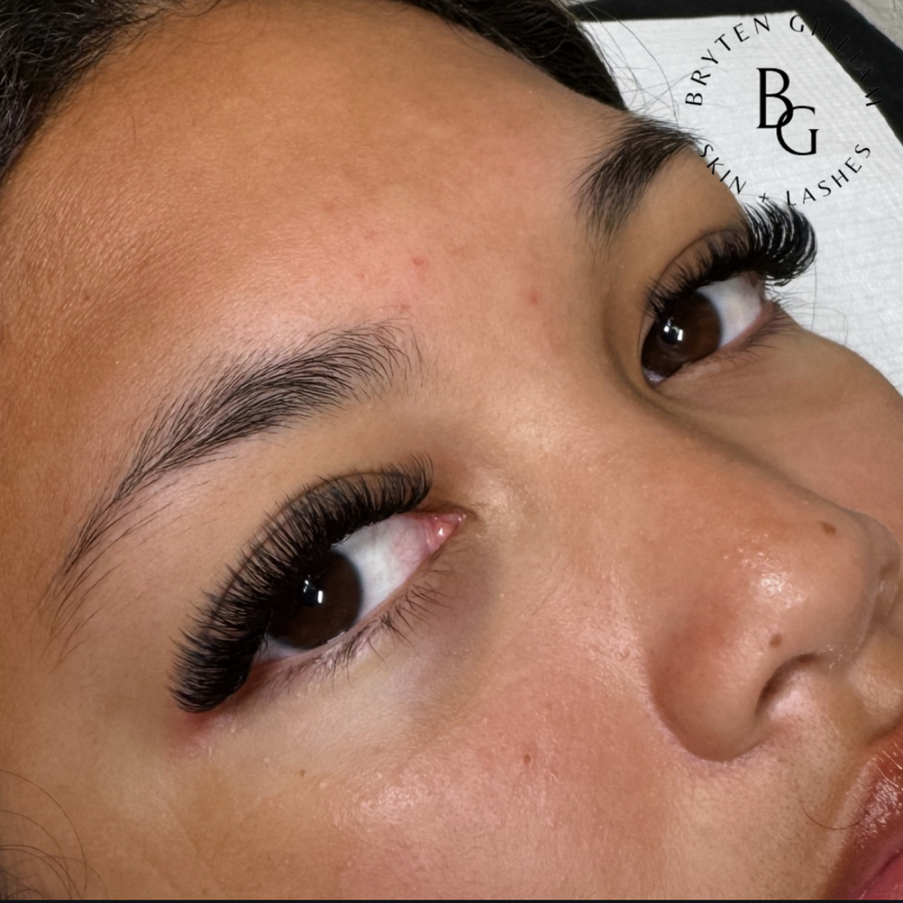 Volume-2 Week Fills at Bryten Gilliam Aesthetics in Brock, TX