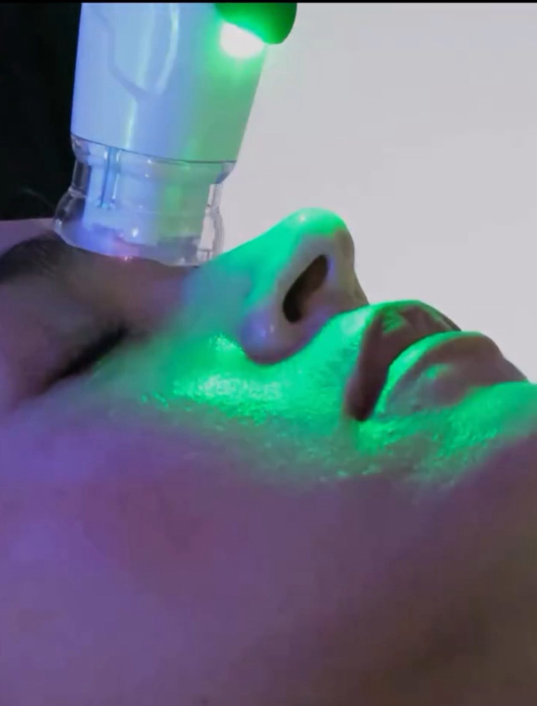 Cold Plasma + Exosomas