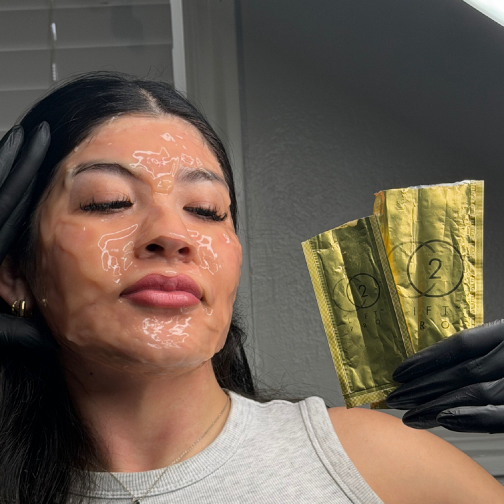 CO2/ Microneedling (Face Only) at Deluxe Beauty Bar in Orem, UT