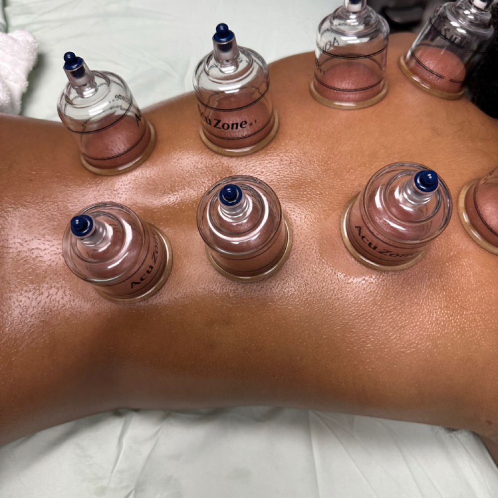 Cupping Therapy at The Neurotherapeutics Massage and Bodywork  LLC in Goldsboro, NC