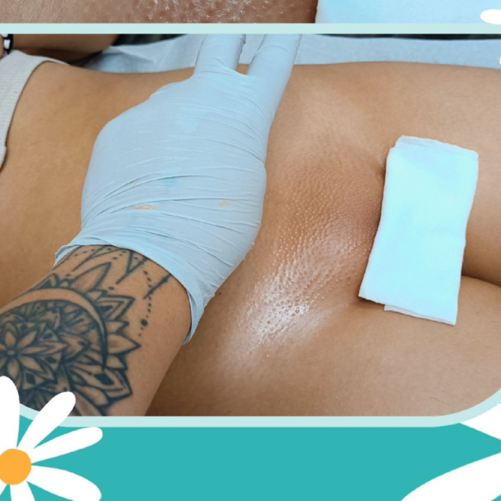 Brazilian wax at Aura Aesthetics in Houston, TX