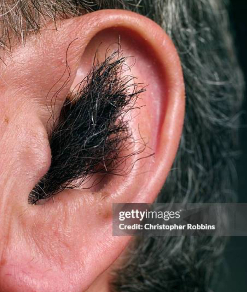 Ear wax