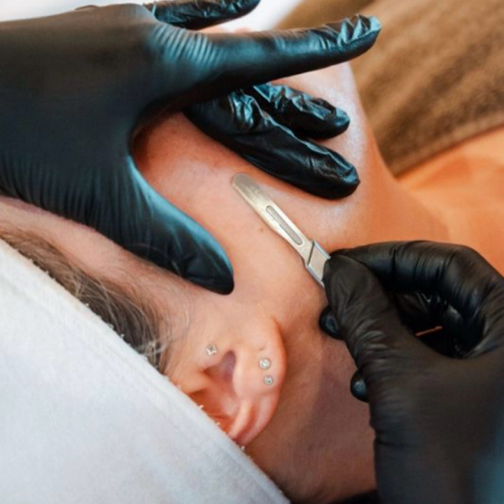 Dermaplane Facial-Treatment at The Face Lounge by Blair in Columbia, MS