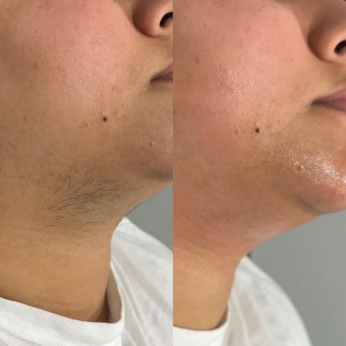 Chin Wax - Depilación de Mentón at Seduce Beauty & Academy in Houston, TX
