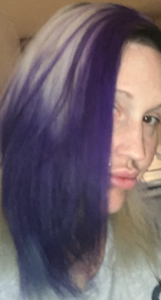 Bleaching and color of choice