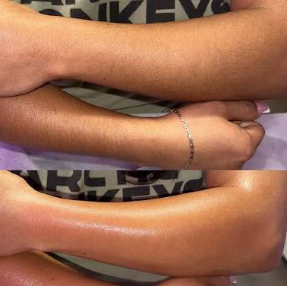 Full Arm Wax at Angelic Skin & Body in Oak Park, IL